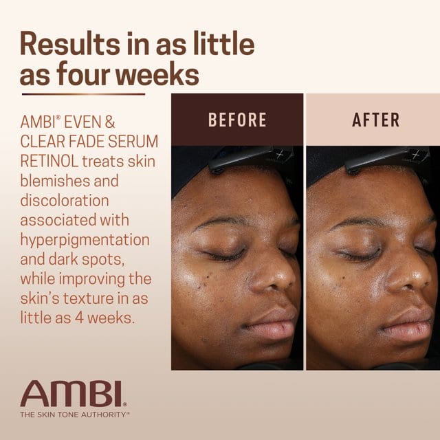 AMBI Even & Clear Facial Fade Serum Retinol 1 OZ