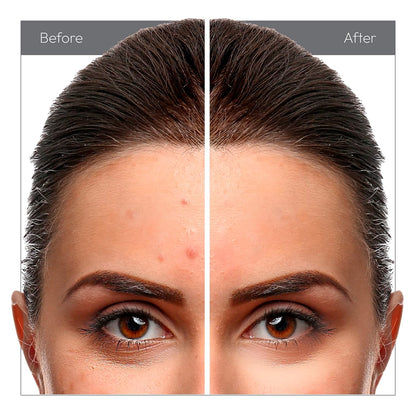 Ruby Kisses All Day Concealer RAC