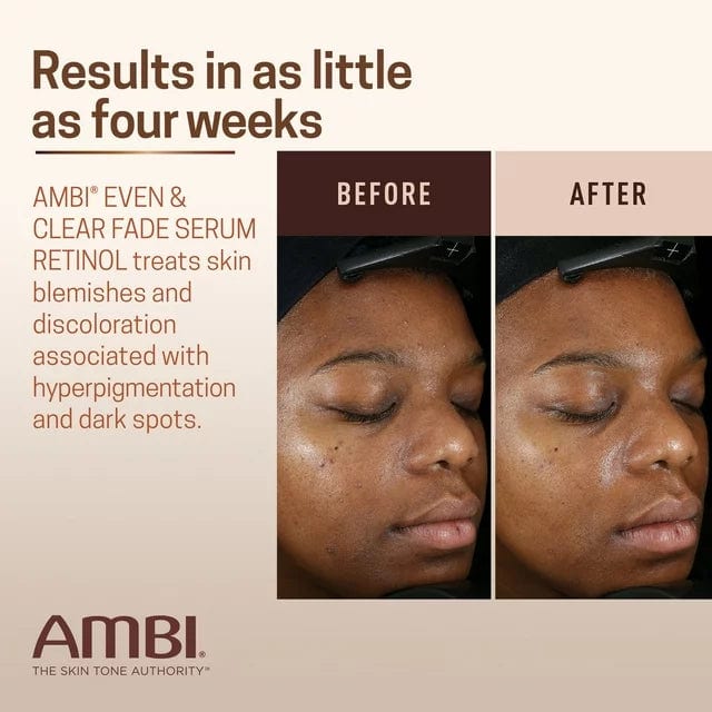 AMBI Even & Clear Facial Fade Serum Retinol 1 OZ