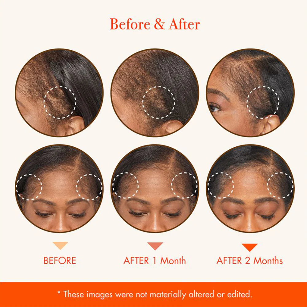 Red By Kiss MD Serum 2 oz GM03