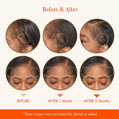 Red By Kiss MD Serum 2 oz GM03